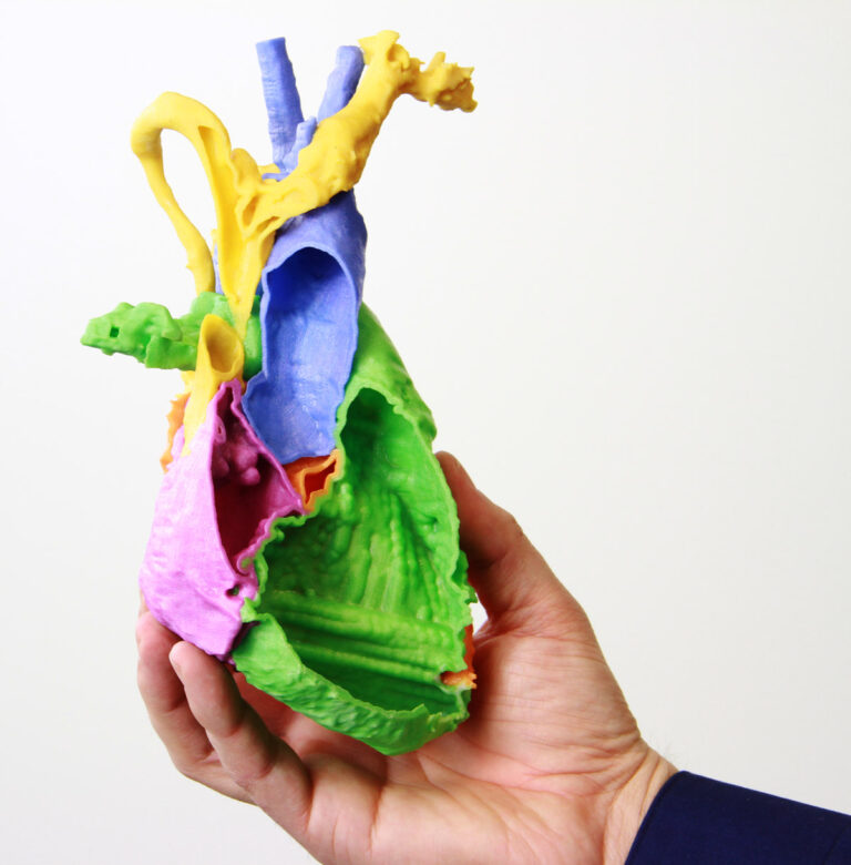 3D printed multicolored medical model of heart chambers