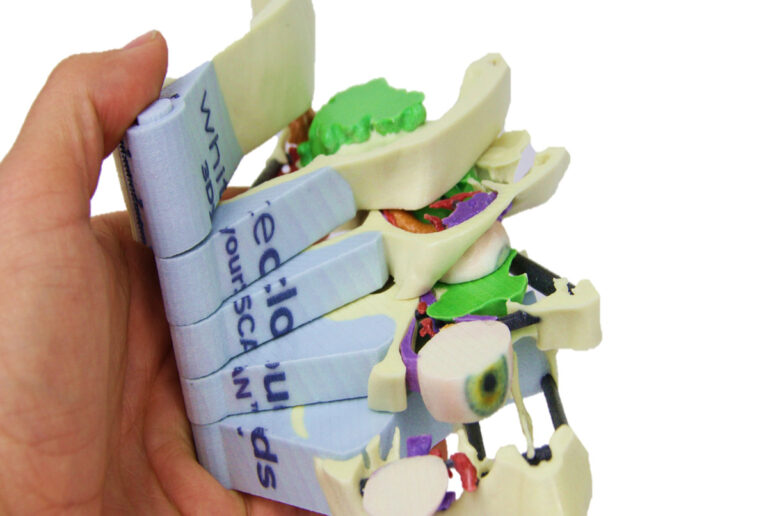 Medical model showing hinge and slice technology